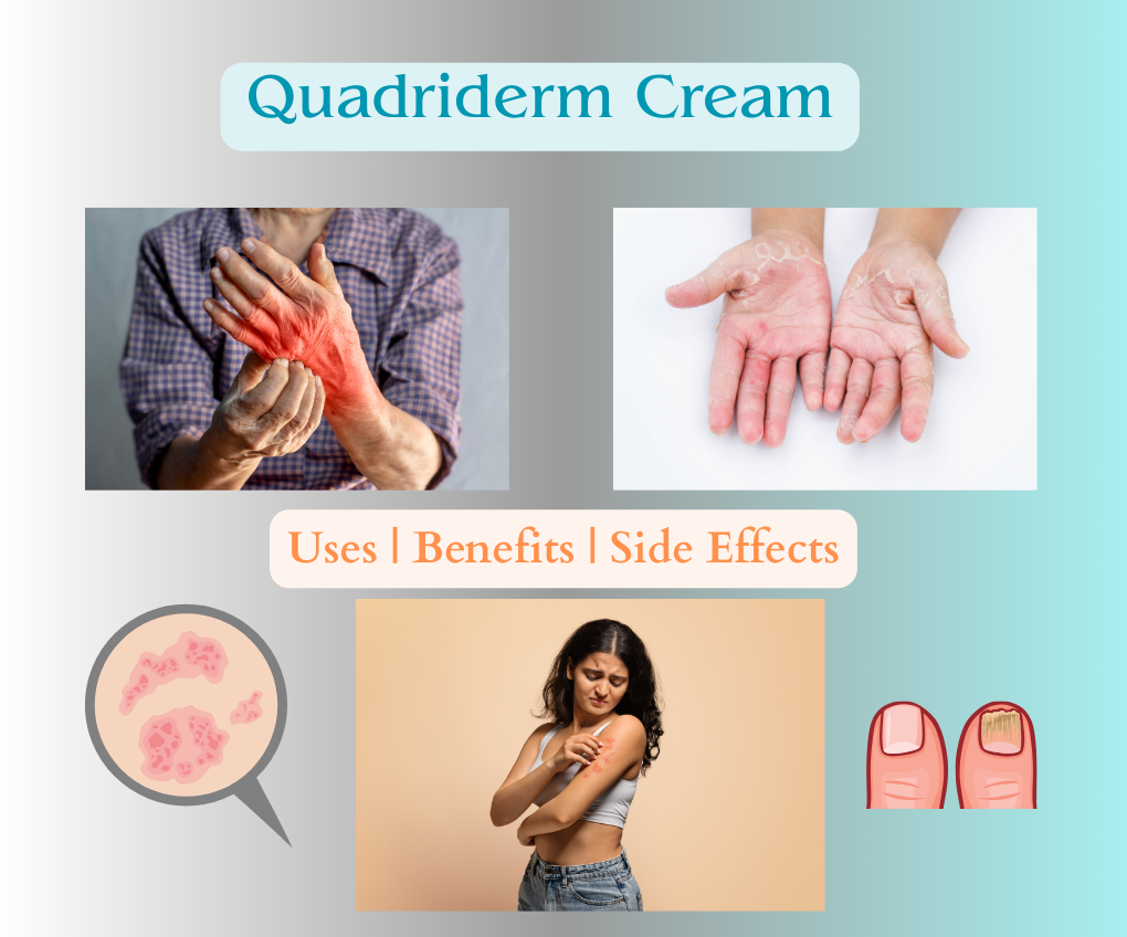 Quadriderm cream: uses, benefits, and side effects explained