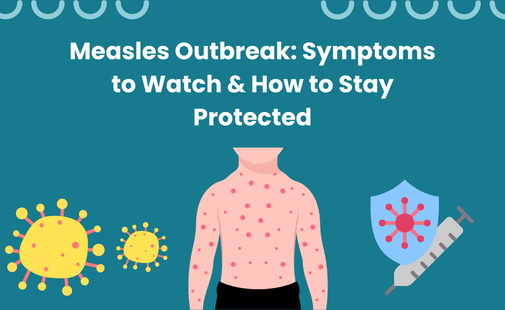 Measles outbreak: symptoms to watch & how to stay protected